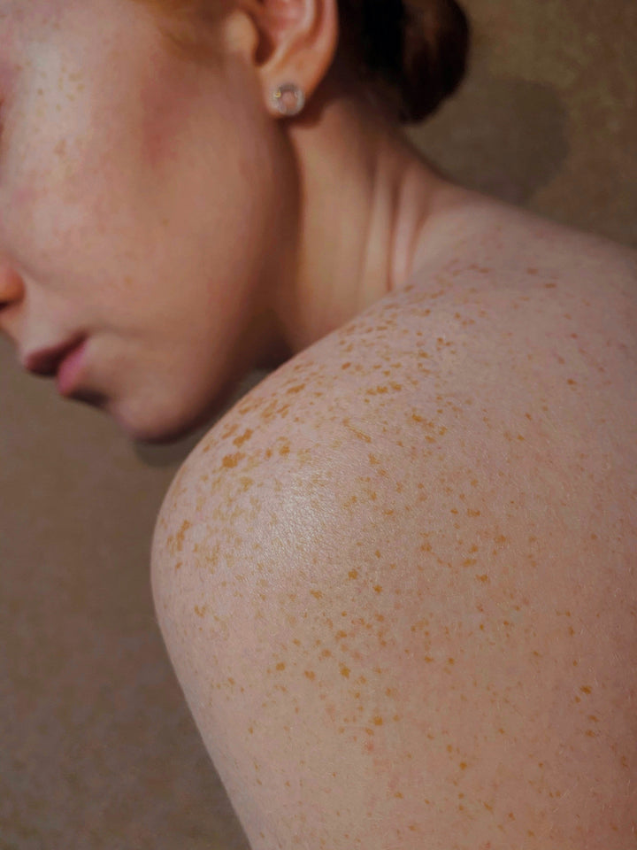 The Ultimate Guide to Azelaic Acid for Clear Skin | SkinRenewal.eu